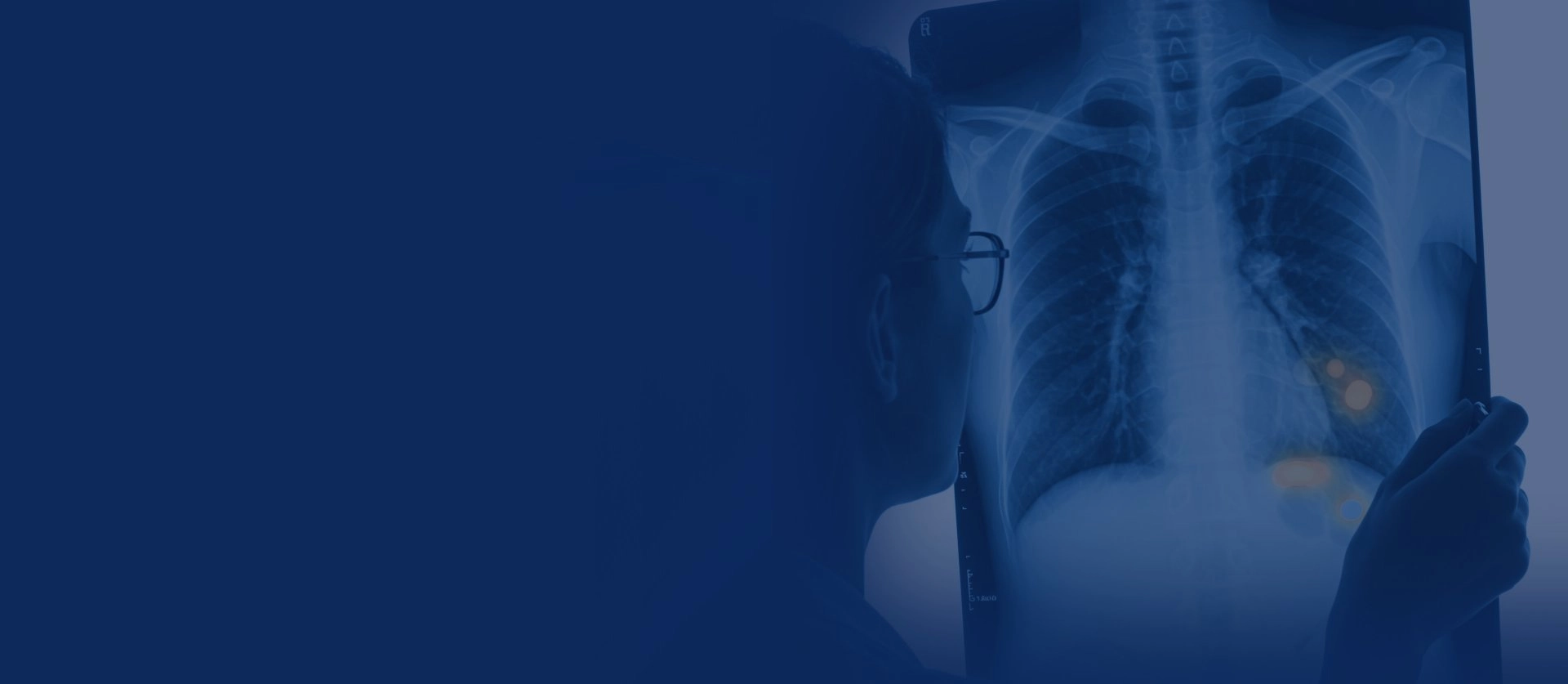 Comprendre image medicale xray